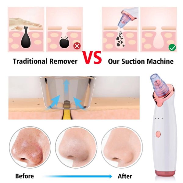 Face Vacuum Blackhead Remover Pore Cleaner